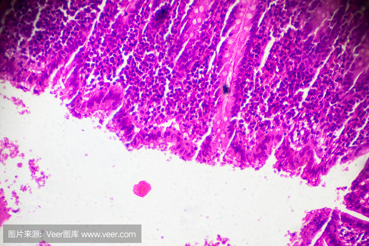 去廊坊做供卵试管婴儿经历