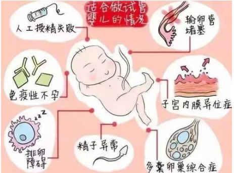 试管二代成功率比一代高吗