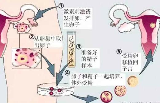 医院代怀成功率高吗移植胚胎会出现延后吗