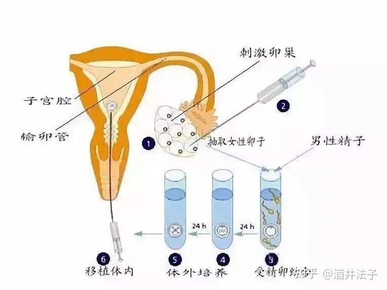 试管供卵自怀自然周期方案使用人群有哪些